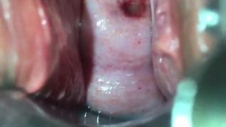 Chinese milf cervix training