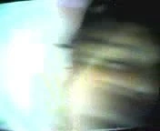 (041)Nurses Zhangjiajing Taiwanese Taiwan