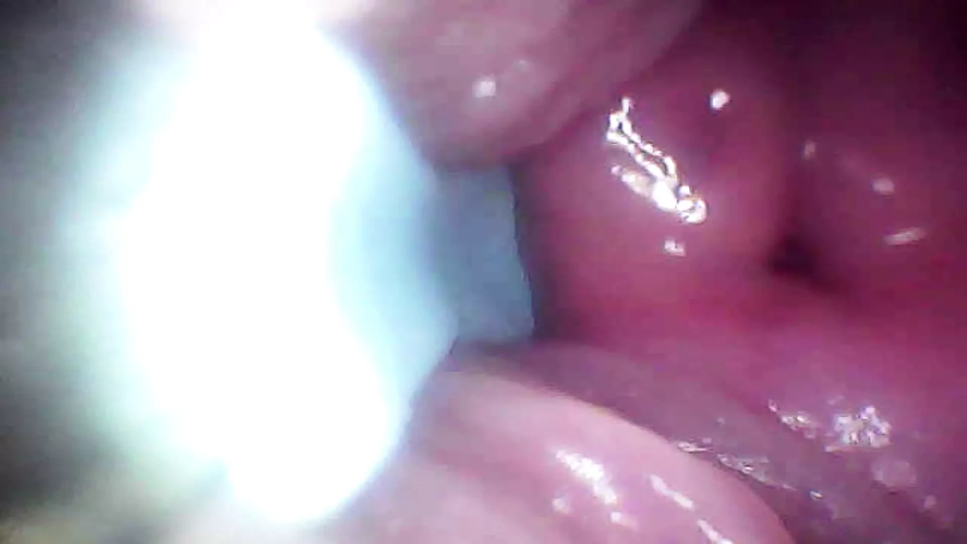 Recorded close-up of a woman’s G-spot (the camera probe goes deep into her)